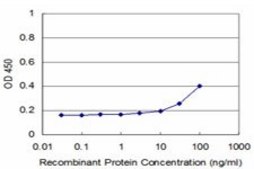 ANTI-RIPK4 antibody produced in mouse clone 4H5, purified immunoglobulin, buffered aqueous solution