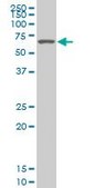 Monoclonal Anti-SMARCD2 antibody produced in mouse clone 2B2, purified immunoglobulin, buffered aqueous solution