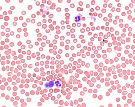 Wright&#8242;s eosin methylene blue solution for microscopy