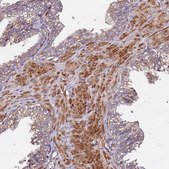 Anti-C17ORF62 antibody produced in rabbit Prestige Antibodies® Powered by Atlas Antibodies, affinity isolated antibody, buffered aqueous glycerol solution