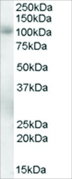 Anti-PDE5A antibody produced in goat affinity isolated antibody, buffered aqueous solution