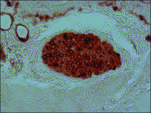 抗S-100（&#946;-亚基）抗体，小鼠单克隆 clone SH-B1, purified from hybridoma cell culture