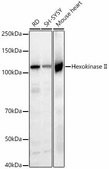 [KO Validated]Anti-Hexokinase II Antibody, clone 5N8G9, Rabbit Monoclonal