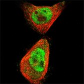 Anti-SLC29A1 antibody produced in rabbit Prestige Antibodies® Powered by Atlas Antibodies, affinity isolated antibody, buffered aqueous glycerol solution