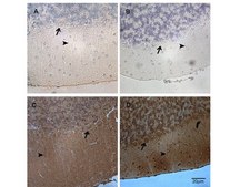 OxyIHC Oxidative Stress Detection Kit The OxyIHC Oxidative Stress Detection Kit contains the chemical &amp; immunological reagents necessary to detect protein oxidation in various tissues from a variety of organs &amp; animal species.