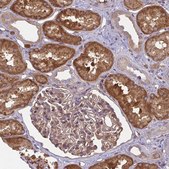 Anti-IFIT3 antibody produced in rabbit Prestige Antibodies® Powered by Atlas Antibodies, affinity isolated antibody, buffered aqueous glycerol solution