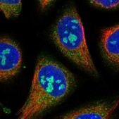 Anti-GTPBP4 antibody produced in rabbit Prestige Antibodies® Powered by Atlas Antibodies, affinity isolated antibody, buffered aqueous glycerol solution