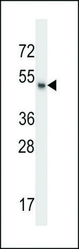 ANTI-MSL1 (CENTER) antibody produced in rabbit affinity isolated antibody, buffered aqueous solution