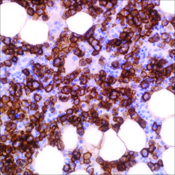 CD138 (EP201) Rabbit Monoclonal Primary Antibody