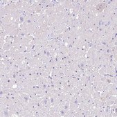 Anti-MYOZ1 antibody produced in rabbit Prestige Antibodies® Powered by Atlas Antibodies, affinity isolated antibody, buffered aqueous glycerol solution