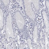 Anti-SLC2A5 antibody produced in rabbit Prestige Antibodies® Powered by Atlas Antibodies, affinity isolated antibody, buffered aqueous glycerol solution