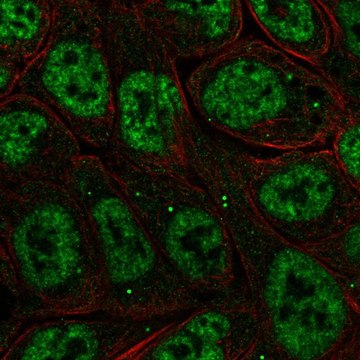 Anti-NFKBIZ antibody produced in rabbit Prestige Antibodies&#174; Powered by Atlas Antibodies, affinity isolated antibody