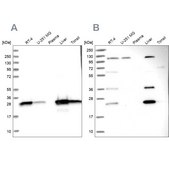 Anti-BLVRB antibody produced in rabbit Prestige Antibodies® Powered by Atlas Antibodies, affinity isolated antibody, buffered aqueous glycerol solution