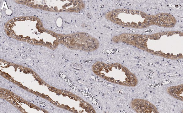 Anti-Pyk2/PTK2B Antibody, clone 3B7 ZooMAb&#174; Rabbit Monoclonal recombinant, expressed in HEK 293 cells