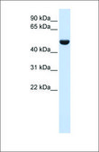 Anti-CD36 affinity isolated antibody