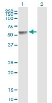 Anti-PPP2R5A antibody produced in mouse IgG fraction of antiserum, buffered aqueous solution