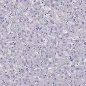 Anti-PHOX2A Prestige Antibodies® Powered by Atlas Antibodies, affinity isolated antibody