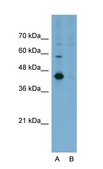 Anti-CEACAM6 IgG fraction of antiserum