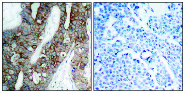 Anti-ITGB3 (Ab-773) antibody produced in rabbit affinity isolated antibody