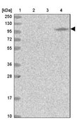 Anti-MOCOS antibody produced in rabbit Prestige Antibodies® Powered by Atlas Antibodies, affinity isolated antibody, buffered aqueous glycerol solution