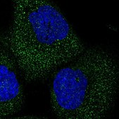 Anti-TELO2 antibody produced in rabbit Prestige Antibodies® Powered by Atlas Antibodies, affinity isolated antibody, buffered aqueous glycerol solution