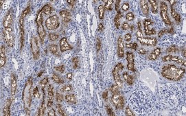 Anti-DIP2B Antibody, clone 2C8, ZooMAb® Rabbit Monoclonal recombinant, expressed in HEK 293 cells