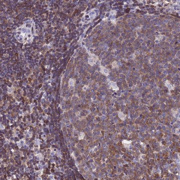 Anti-CNN2 antibody produced in rabbit Prestige Antibodies&#174; Powered by Atlas Antibodies, affinity isolated antibody, buffered aqueous glycerol solution