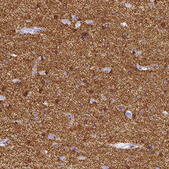 Anti-CACNA1A antibody produced in rabbit Prestige Antibodies® Powered by Atlas Antibodies, affinity isolated antibody, buffered aqueous glycerol solution