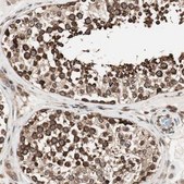 Anti-NUP62 antibody produced in rabbit Prestige Antibodies® Powered by Atlas Antibodies, affinity isolated antibody, buffered aqueous glycerol solution