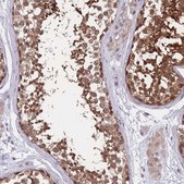 Anti-UBE2N antibody produced in rabbit Prestige Antibodies® Powered by Atlas Antibodies, affinity isolated antibody, buffered aqueous glycerol solution