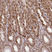 Anti-ZMAT2 antibody produced in rabbit Prestige Antibodies® Powered by Atlas Antibodies, affinity isolated antibody, buffered aqueous glycerol solution