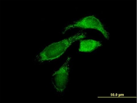 Anti-OXCT1 antibody produced in mouse purified immunoglobulin, buffered aqueous solution