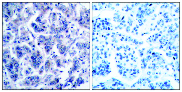 Anti-TYK2 antibody produced in rabbit affinity isolated antibody