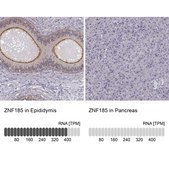 Anti-ZNF185 antibody produced in rabbit Prestige Antibodies® Powered by Atlas Antibodies, affinity isolated antibody, buffered aqueous glycerol solution