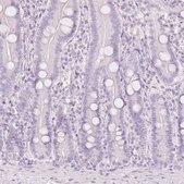 Anti-LECT2 antibody produced in rabbit Prestige Antibodies® Powered by Atlas Antibodies, affinity isolated antibody, buffered aqueous glycerol solution