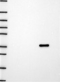 Anti-Sptlc2 Antibody Produced In Rabbit Prestige Antibodies® Powered by Atlas Antibodies, affinity isolated antibody, buffered aqueous glycerol solution