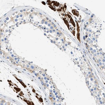 Anti-ULK4 antibody produced in rabbit Prestige Antibodies&#174; Powered by Atlas Antibodies, affinity isolated antibody, buffered aqueous glycerol solution