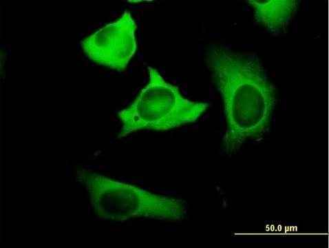 Anti-FASN antibody produced in mouse purified immunoglobulin, buffered aqueous solution