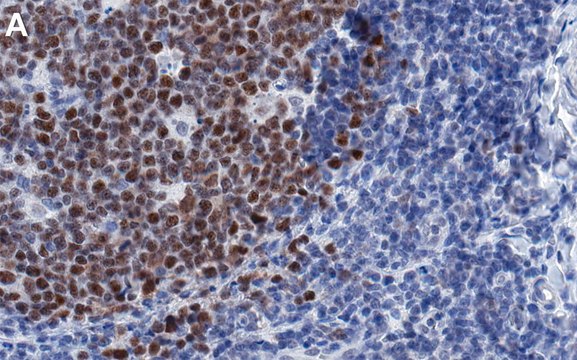 Anti-DNMT1 Antibody, clone 1L14 ZooMAb&#174; Rabbit Monoclonal recombinant, expressed in HEK 293 cells