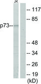 Anti-P73 antibody produced in rabbit affinity isolated antibody