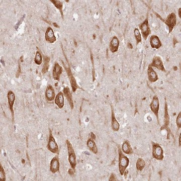 Anti-TMIE antibody produced in rabbit Prestige Antibodies&#174; Powered by Atlas Antibodies, affinity isolated antibody, buffered aqueous glycerol solution