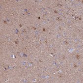 Anti-CLEC2L antibody produced in rabbit Prestige Antibodies® Powered by Atlas Antibodies, affinity isolated antibody, buffered aqueous glycerol solution