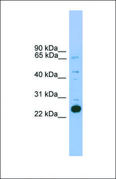 Anti-NKX2-6, (N-terminal) antibody produced in rabbit affinity isolated antibody