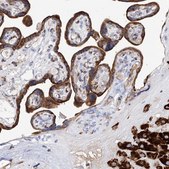 Anti-PDIA5 antibody produced in rabbit Prestige Antibodies® Powered by Atlas Antibodies, affinity isolated antibody, buffered aqueous glycerol solution, ab1
