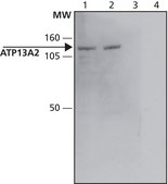 Anti-ATP13A2 (C-terminal) antibody produced in rabbit ~1.5 mg/mL, affinity isolated antibody, buffered aqueous solution