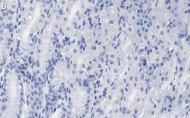 Anti-PNPT1 Antibody, clone 2D23 ZooMAb® Rabbit Monoclonal recombinant, expressed in HEK 293 cells