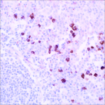 IgA (EP170) Rabbit Monoclonal Primary Antibody