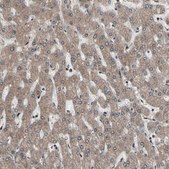 Anti-PSMA2 antibody produced in rabbit Prestige Antibodies® Powered by Atlas Antibodies, affinity isolated antibody, buffered aqueous glycerol solution