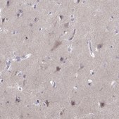Anti-VGF antibody produced in rabbit Prestige Antibodies® Powered by Atlas Antibodies, affinity isolated antibody