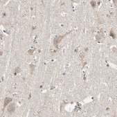 Anti-MAP3K10 antibody produced in rabbit Prestige Antibodies® Powered by Atlas Antibodies, affinity isolated antibody, buffered aqueous glycerol solution